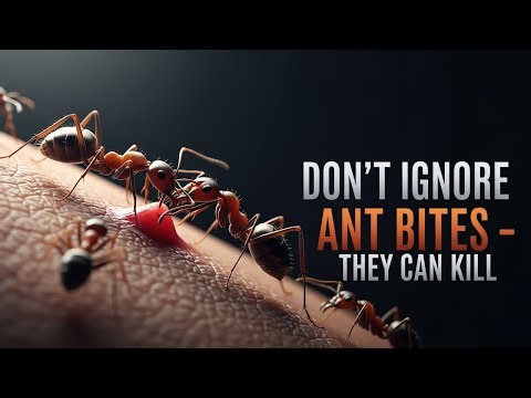 Don’t Ignore Ant Bites – They Can Kill