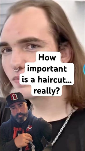 Want Your Hairline Back? Try This Free Simulator First