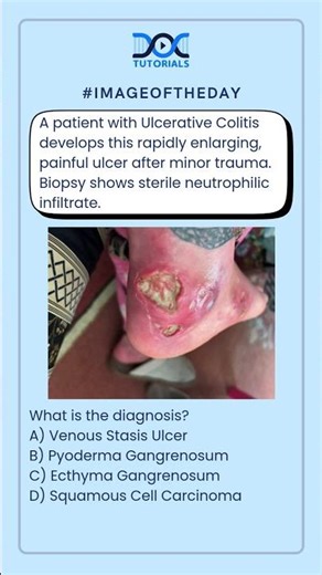 What is the diagnosis?