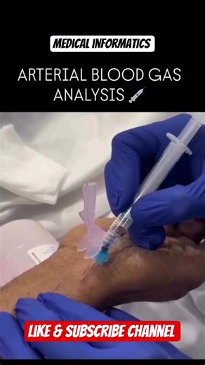 ABG ANALYSIS #medicalstudent #medication #medicaleducation