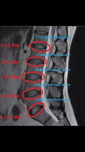 #anatomy #MRI #bones #t1mri | CT Scan and MRI study
