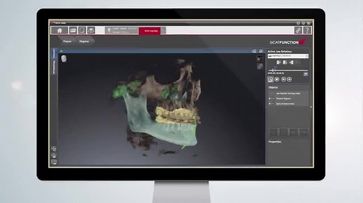 3.3K views · 107 reactions | SICAT Function - Track real motion in motion. SICAT Function is the first integrated digital 3D solution to visualize real patient-individual movement of the lower jaw within the 3D volume. The anatomic traces of the temporomandibular joint can be displayed for every possible position in the volume. #IDS #IDS2015 #provendigitalsolutions | Dentsply Sirona | Facebook