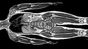 Comment fonctionne une IRM ?