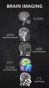 Brain Imaging by various Techniques | Brain 🧠 Images | Medi Queries