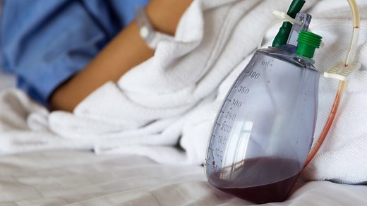 Drain de Redon : rôle, indications, ablation, surveillance