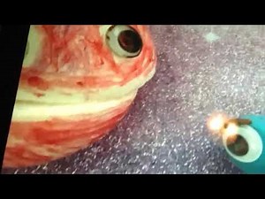 TOI 700 System- The Nians™