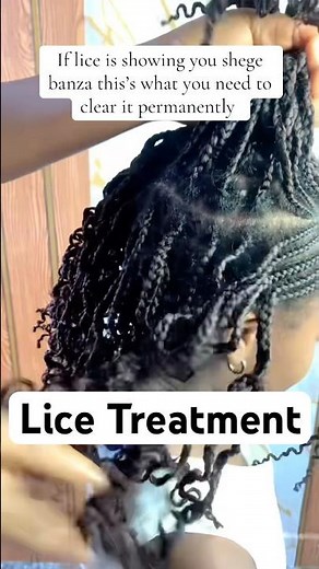Get rid of hair lice and nits ( lice eggs) without cutting your hair #licetreatment