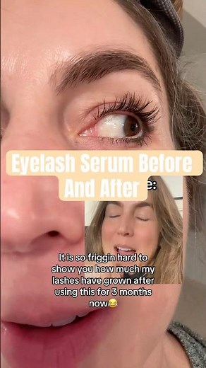 Lash serum before and after👀 #eyelashes #eyelashserum
