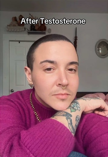 The Journey of Transmasc Individuals Before and After Testosterone