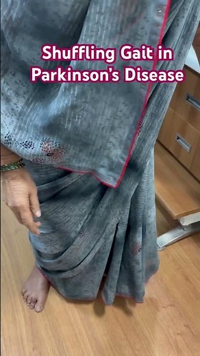 Shuffling gait, bradykinesia, stooped posture, and postural instability in Parkinson’s Disease