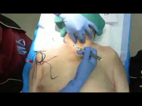 Scotty Bolleter, BS, EMT-P: Live Cadaver Lab (3/27/26)