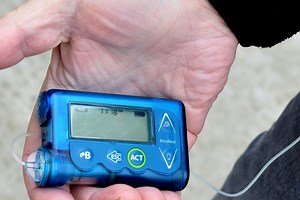 DIY Artificial Pancreas System for Type 1 Diabetes Gets Nod From Experts