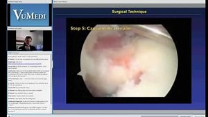 Arthroscopic Bankart-Bristow-Laterjet