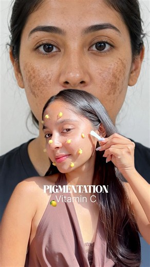 You need to KNOW this 💯🤌 Skincare tips for different skin types#glowingskin#skincare#beauytips#try
