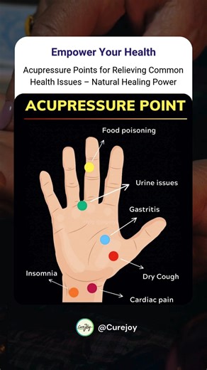 Acupressure is an ancient healing technique that uses the application of pressure to specific points on the body, known as acupoints, to relieve various health issues. This hand diagram highlights common acupressure points that can help with issues such as insomnia, food poisoning, dry cough, and even cardiac pain. By simply applying pressure to the points on the hand as shown, you can naturally support your body's healing process. For example, the blue point addresses insomnia, while the yellow