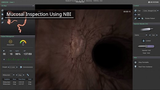 Have you tried the EMR/ESD module on the GI Mentor? Endoscopic...