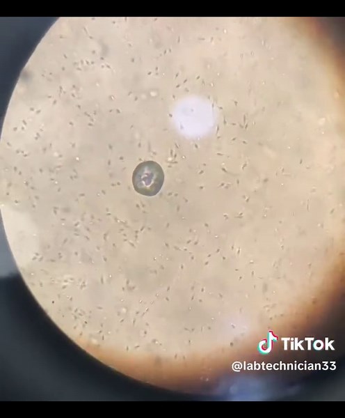 Understanding Semen Analysis for Laboratory Students