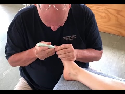 Foot reflexology massage using tools. Deep tissue foot massage. Brandon massaging Teresa in Tauranga