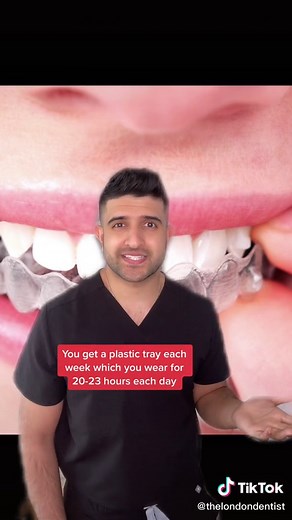 Understanding the Invisalign Process: A Comprehensive Guide