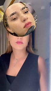 Natural Lips ICONIC LIPS | Clinica Beauty Art Aesthetics | Facebook