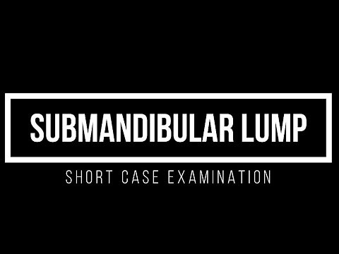 Submandibular Lump - Short Case Examination - Dr. Priyantha Maduranga