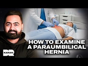 How to assess and examine a hernia (Paraumbilical) | Dr Karan