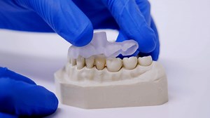 Guided Endodontics: Three-Dimensional Planning and Template-Aided Preparation of Endodontic Access Cavities