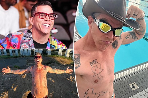Steve-O canceled breast implants surgery after ‘profound’ conversation with a transgender stranger
