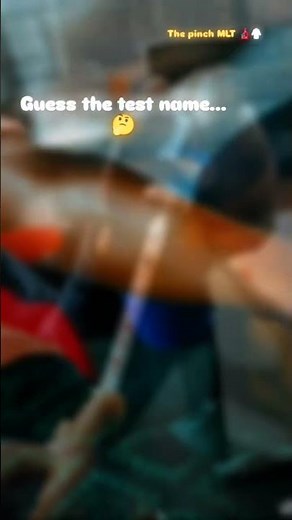 montex test for tuberculosis #bmlt #tuberkulosis #pathologylab #viral #trendingshorts #shorts