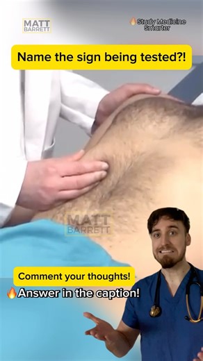 Dr Matt Barrett MBBS BSc | Study Medicine Smarter on Instagram: "⚠️Tap here for the answer! ✅ Spoiler alert: Murphys sign Here you can see a patient undergoing murphys test - a classic sign of acute cholecystitis. The gallbladder sits just below the right costal margin… Murphy sign is elicited by pressing firmly under the right costal margin and asking your patient to take a deep breath. Inspiration causes the diaphragm to flatten, pushing down the liver and edge of the gallbladder towards your 