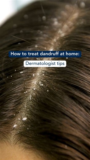 AmericanAcademyofDermatology on Instagram: "Treat mild dandruff at home by following these dermatologist tips."