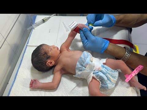 Tiny Fighter 💕 IUGR Baby Treatment Journey Begins in NICU”