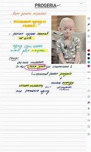 Progeria explained in 60 seconds-The disease that ages children fast #progeria #raredisease