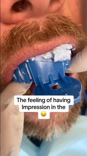 Alginate impression in dental chair #smiledentist #dentist