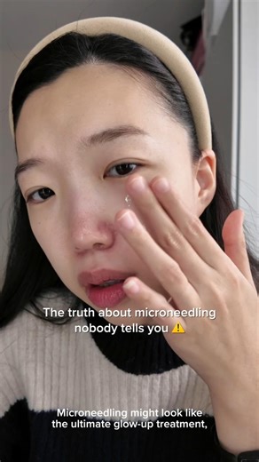 Microneedling results with Numbuzin No.9 NAD+ BIO ✨ l #numbuzin #microneedling #antiaging #kbeauty