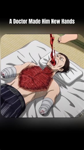 The Doctor Who Gave Him New Hands | #anime #shorts