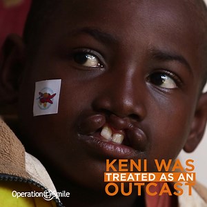 3.1K reactions · 204 shares | Keni waited nine long years and walked 36 hours to have surgery that changed his life forever. Help transform the lives of children like Keni each and every month. You'll create lasting hope for children with cleft conditions. Please give monthly. | Operation Smile | Facebook