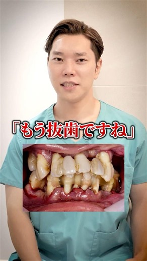 Can your teeth be saved!? The world's first cutting-edge treatment for periodontal disease [Blue ...