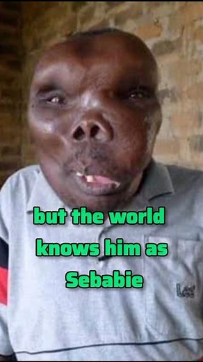 World Alleged Ugliest Man...Ssebabi #nature #facts #life #top10 #reaction #news