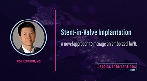 Stent-in-Valve Implantation - Cardiac Interventions Today