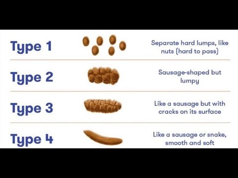 Fecal Softeners or stool softeners; laxatives that soften stool by water and fats to penetrate it