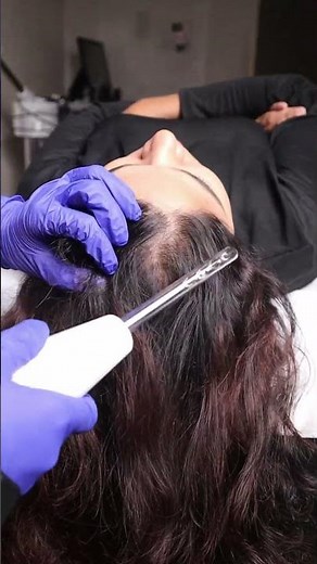 How We Treat Dandruff Professionally (Step-by-Step) | HSR Layout clinic