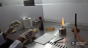 35 reactions | Negative staining is used for detection of capsule in bacteria, like Pneumococcus and Klebsiella. We also called this stain as India ink staining because in this stain we used India ink or nigrosin as a dye. | Uttaranchal P.G. College of Bio-Medical Sciences & Hospital | Facebook