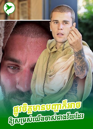 278K views · 10K reactions | ស្ត្រេសតានតឹង កើតទុក្ខរាល់ថ្ងៃ...