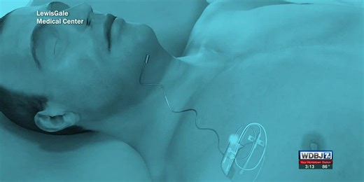 Here @ Home shows new treatment option for patients with sleep apnea