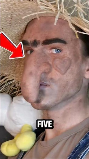 Top 5 REMARKABLE HUMANS THAT ARE ONE IN A MILLION.