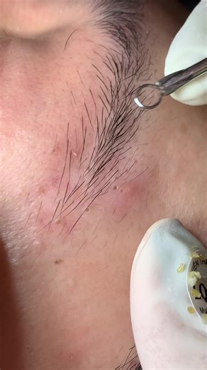 Comprehensive Care: Cham Soc Da Mun