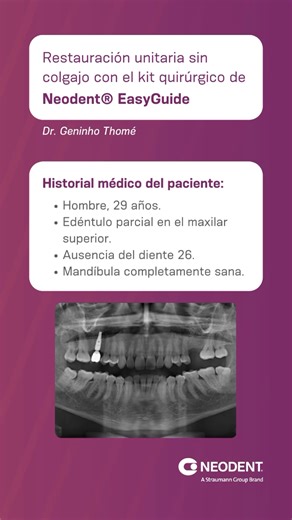 El Dr. Geninho Thomé muestra cómo realiza una restauración unitaria sin colgajo en el maxilar superior utilizando el kit quirúrgico de Neodent® EasyGuide. El resultado fue muy satisfactorio tanto para el paciente como para el doctor. ¡No te lo pierdas en este vídeo!▶️ #Neodent #NeodentEasyGuide #implantología #casosclínicos #odontologíaavanzada | Neodent