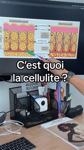 ⬇️Encore plus d’infos sur la cellulite - Qu’est-ce que la cellulite ? La cellulite est une modification du tissu sous-cutané qui associe : \t•\tdes cellules graisseuses qui augmentent de volume, \t•\tun tissu conjonctif qui se rigidifie, \t•\tune circulation sanguine et lymphatique ralentie. - La cellulite est-elle uniquement liée au poids ? Non. La cellulite touche des femmes minces comme des femmes rondes. Elle est influencée par : \t•\tles hormones (œstrogènes), \t•\tla génétique, \t•\tla cir