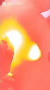 SEA HEART'S Clinical Demonstration of Highly Configurable Long Pulse Machine